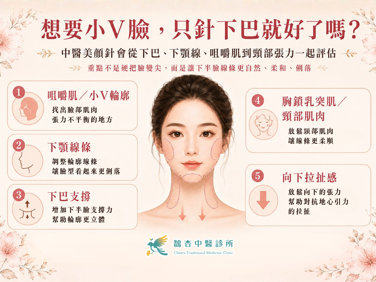 想要小V臉，只針下巴就好了嗎？美顏針如何評估下顎線、咀嚼肌與頸部張力