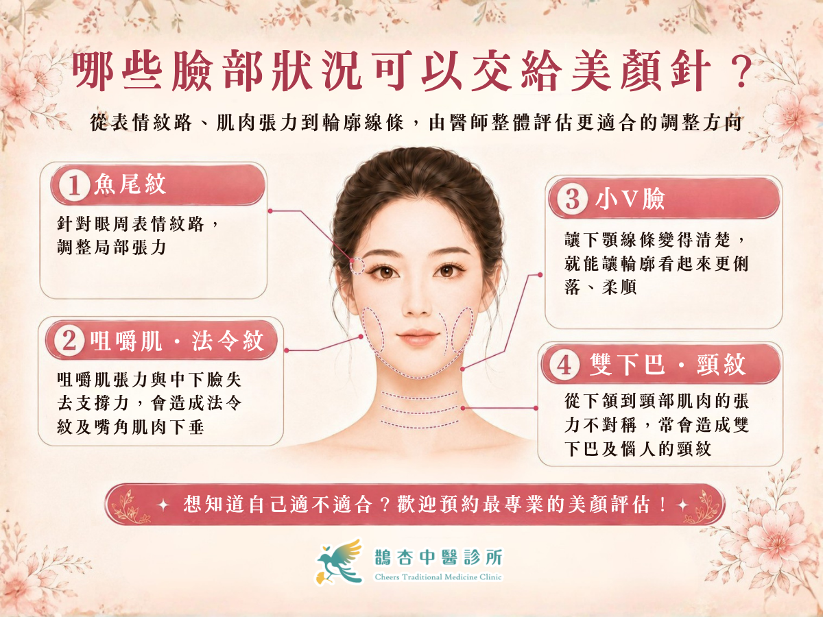 美顏針可以處理什麼臉部線條？法令紋、下顎線與下巴支撐一次看懂